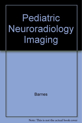 Pediatric Neuroradiology: Imaging of the Developing Brain