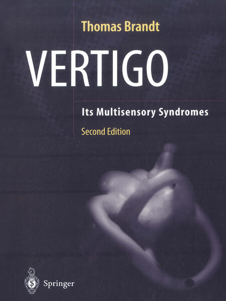 Vertigo
