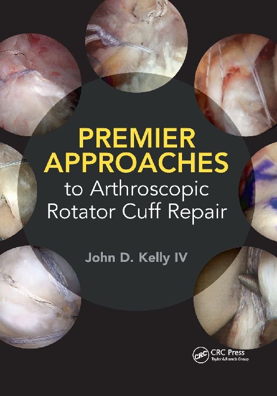 Premier Approaches to Arthroscopic Rotator Cuff Repair