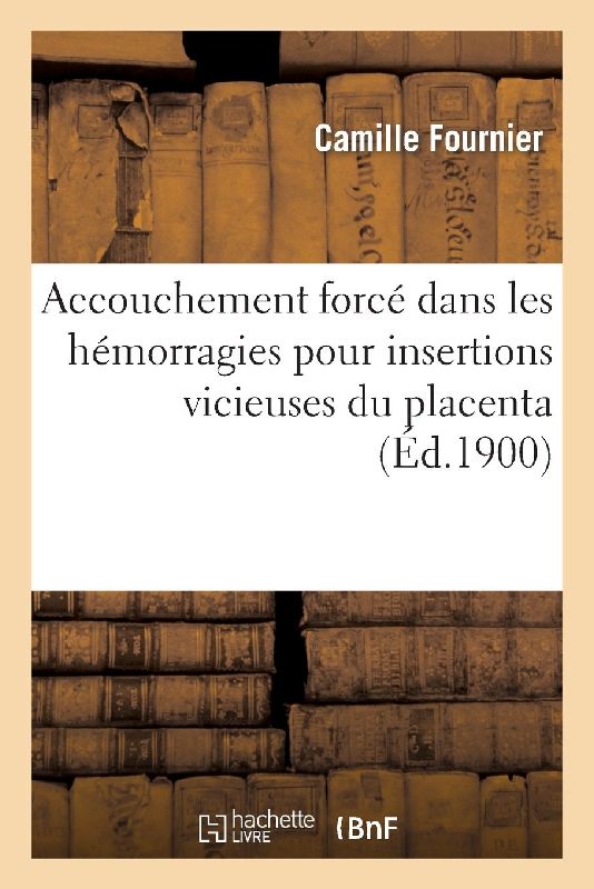 Accouchement Forcé Dans Les Hémorragies Pour Insertions Vicieuses Du Placenta