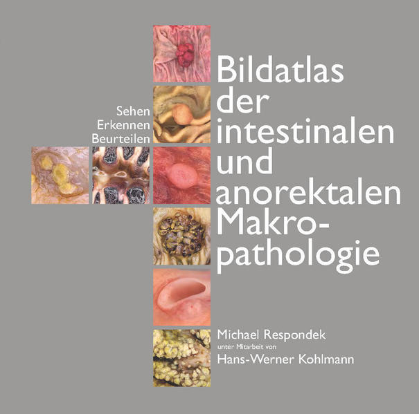 Bildatlas der intestinalen und anorektalen Makropathologie