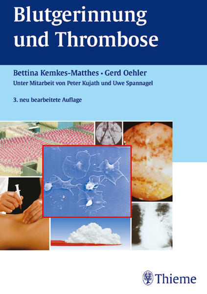 Blutgerinnung und Thrombose