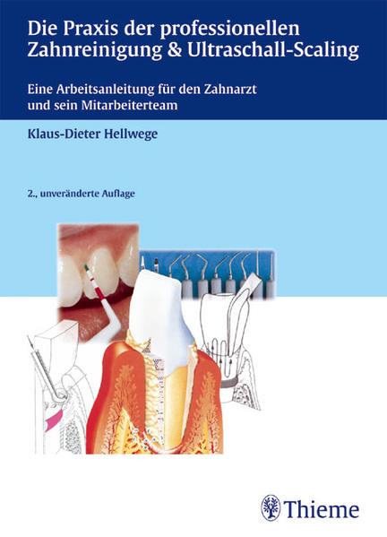Die Praxis der professionellen Zahnreinigung & Ultraschall-Scaling