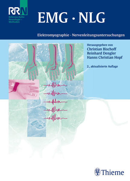 EMG  NLG Elektromyographie und Nervenleitungsuntersuchungen