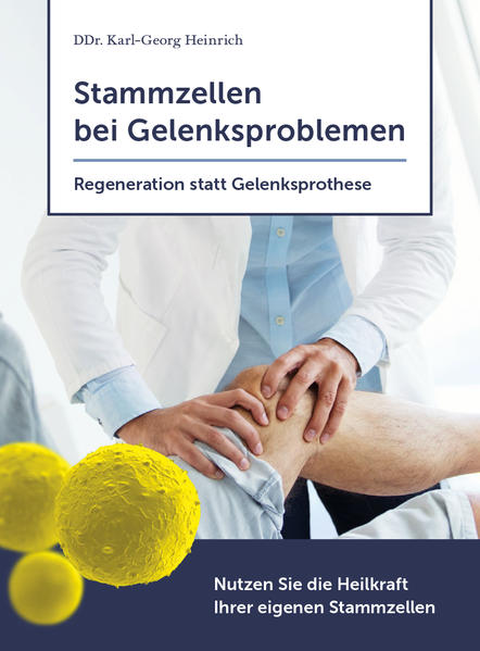 Stammzellen bei Gelenksproblemen