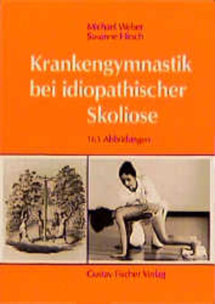 Krankengymnastik bei idiopathischer Skoliose