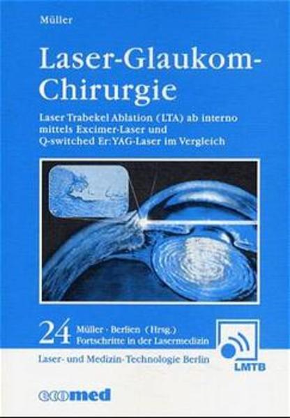 Laser-Glaukom-Chirurgie
