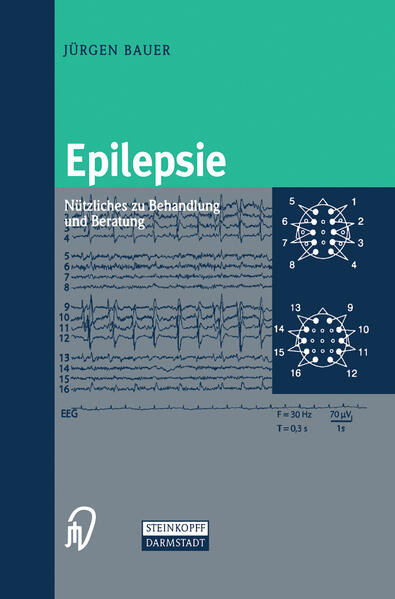 Epilepsie
