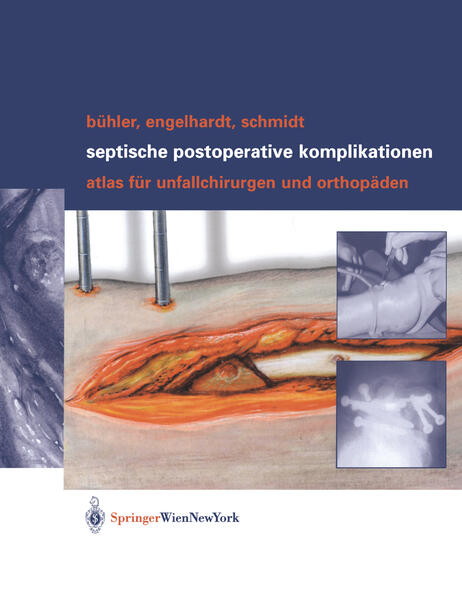 Septische postoperative Komplikationen