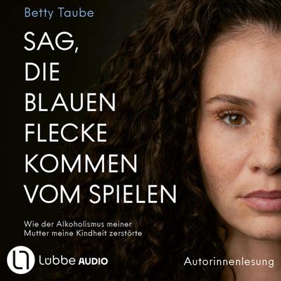Sag, die blauen Flecke kommen vom Spielen