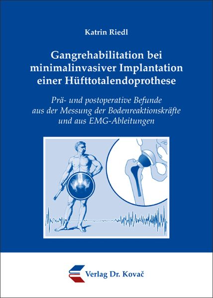 Gangrehabilitation bei minimalinvasiver Implantation einer Hüfttotalendoprothese