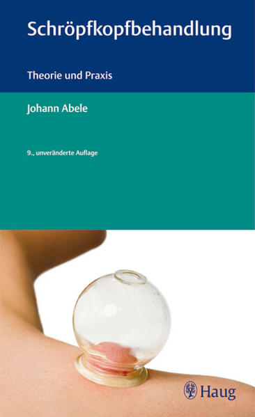 Schröpfkopfbehandlung