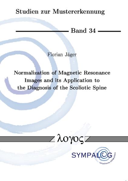 Normalization of Magnetic Resonance Images and its Application to the Diagnosis of the Scoliotic Spine