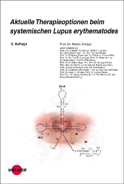 Aktuelle Therapieoptionen beim systemischen Lupus erythematodes