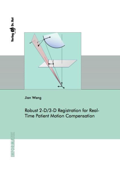 Robust 2-D/3-D Registration for Real-Time Patient Motion Compensation