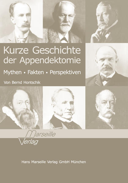 Kurze Geschichte der Appendektomie