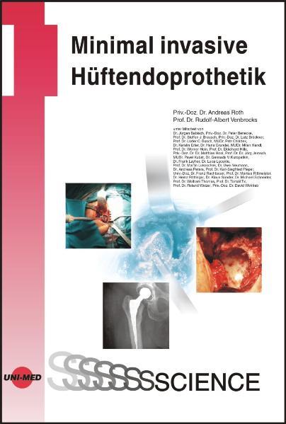 Minimal invasive Hüftendoprothetik