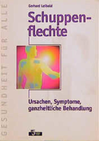 Schuppenflechte