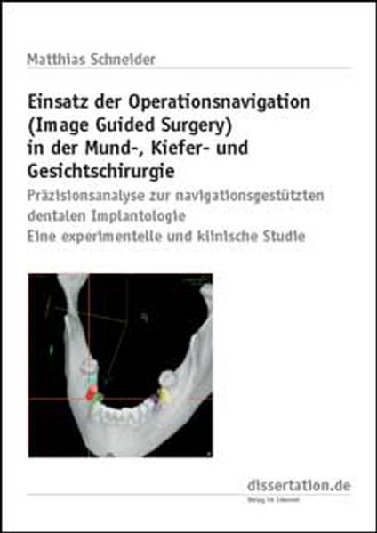 Einsatz der Operationsnavigation (Image Guided Surgery) in der Mund-, Kiefer- und Gesichtschirurgie