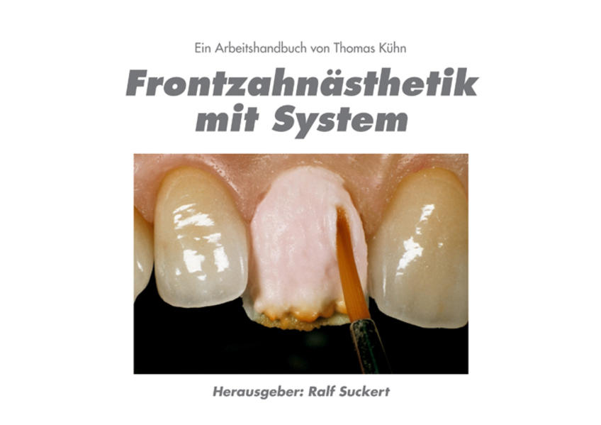 Frontzahnästhetik mit System