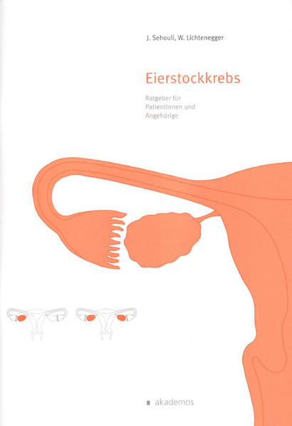 Eierstockkrebs
