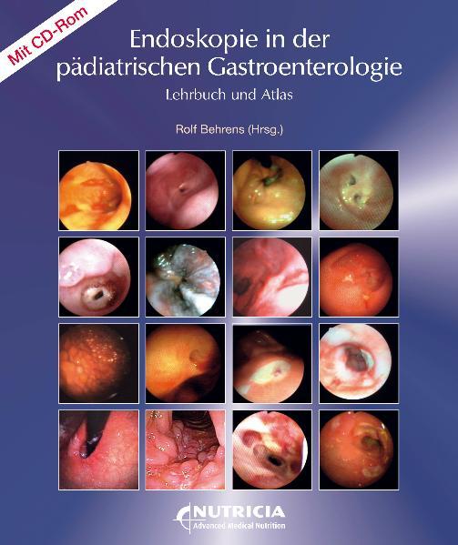 Endoskopie in der pädiatrischen Gastroenterologie