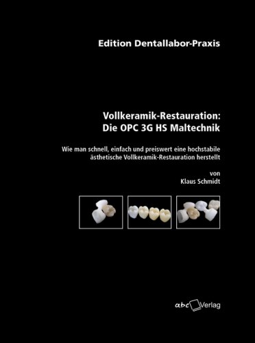 Dentallabor-Praxis Vollkeramik-Restauration: Die OPC 3G HS Maltechnik
