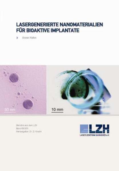 Lasergenerierte Nanomaterialien für bioaktive Implantate