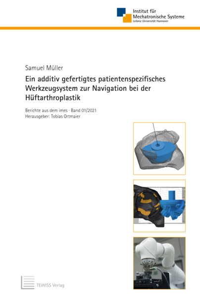 Ein additiv gefertigtes patientenspezifisches Werkzeugsystem zur Navigation bei der Hüftarthroplastik