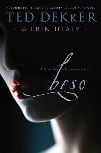Beso: Ella te roba más que el corazón