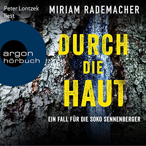 Durch die Haut: Soko Sennenberger 2