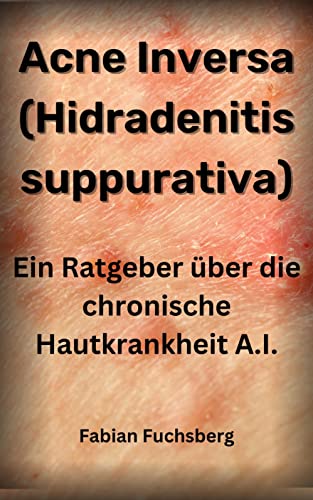 Acne Inversa (Hidradenitis Suppurativa): Ein Ratgeber über die chronische Hautkrankheit Acne Inversa